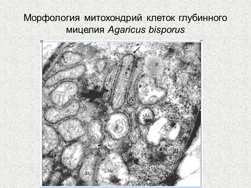 Морфология митохондрий клеток глубинного мицелия Agaricus bisporus